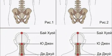 Как да изправите гърба си - стъпка по стъпка. 1